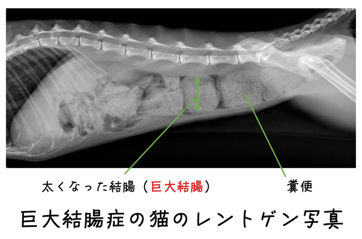 巨大結腸症の猫のレントゲン写真。太くなった結腸と、その中に溜まった糞便が写っている
