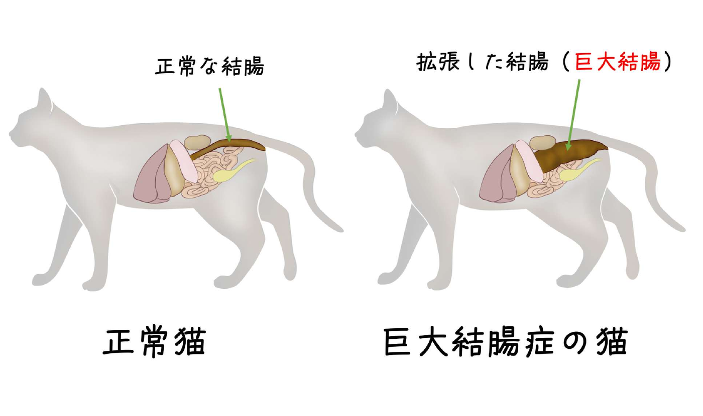 正常な猫の結腸と、拡張した結腸（巨大結腸）を並べた図解